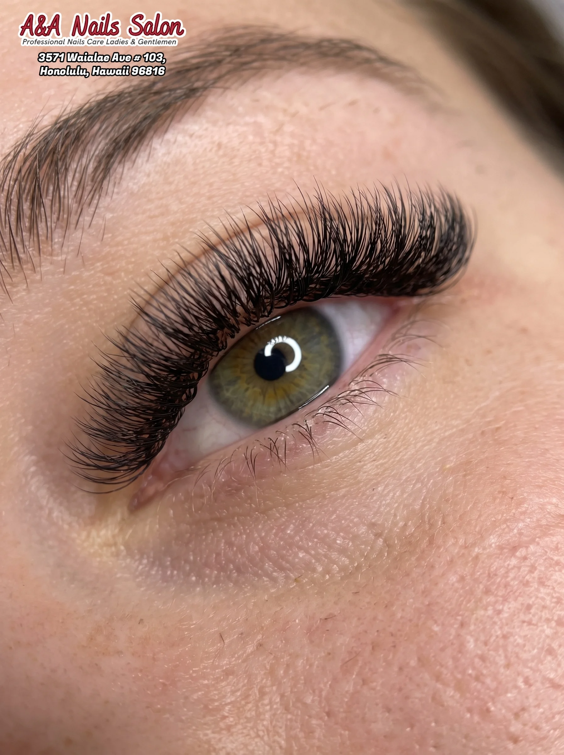 Eye